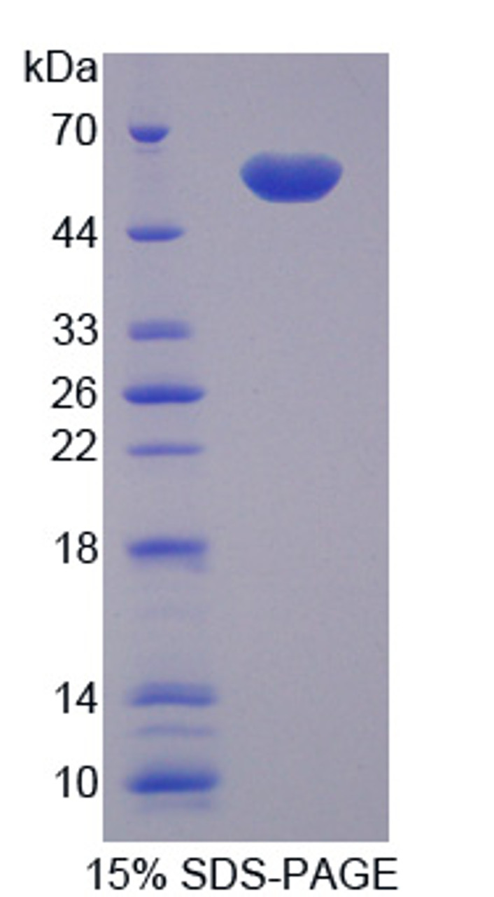 Human Recombinant Visfatin (VF)