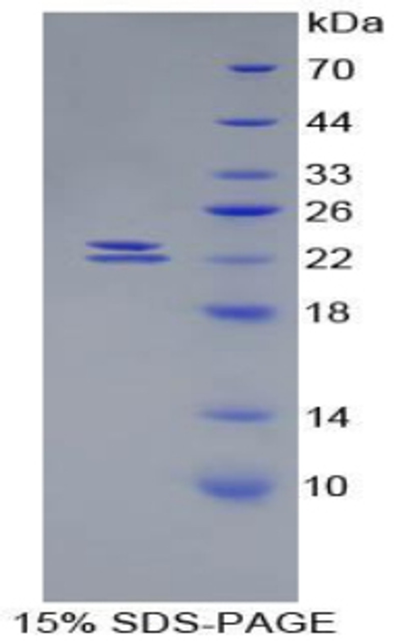 Mouse Recombinant Bone Morphogenetic Protein 1 (BMP1)