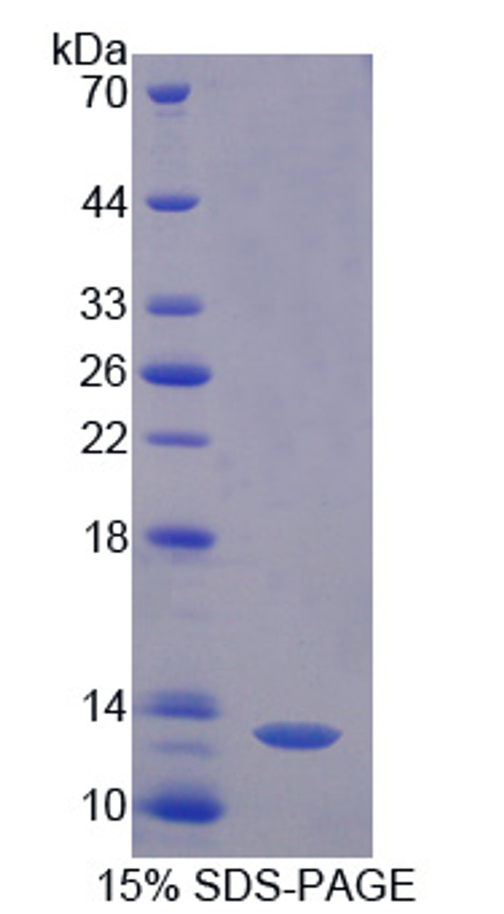 Pig Recombinant Diamine Oxidase (DAO)