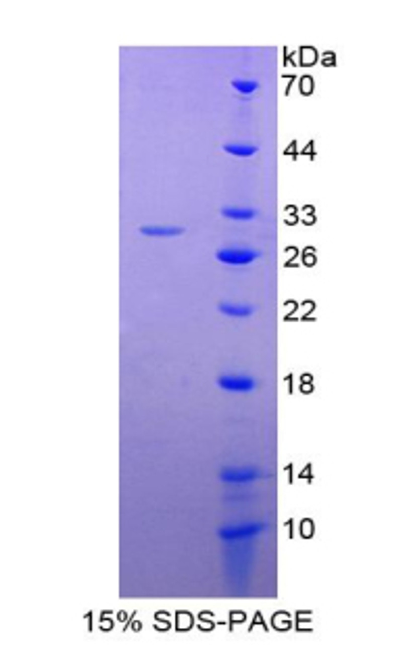 Rat Recombinant Glutathione S Transferase Alpha 4 (GSTa4)