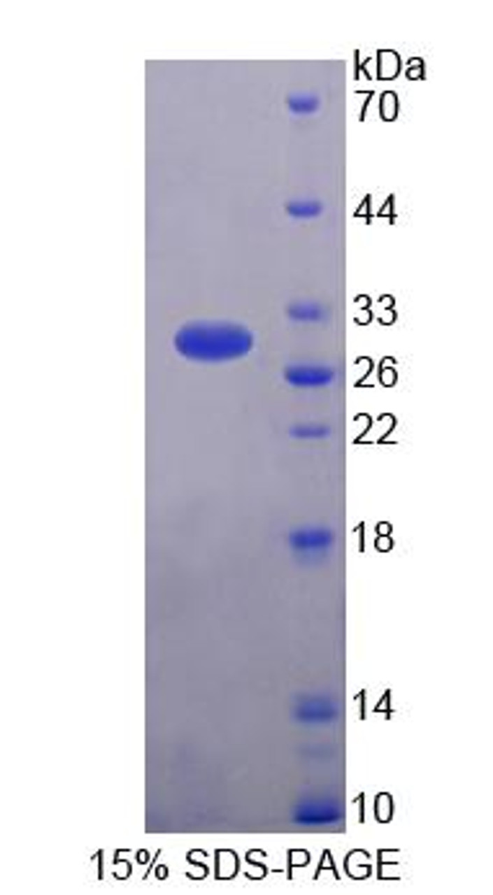 Chicken Recombinant Glutathione S Transferase Alpha 3 (GSTa3)