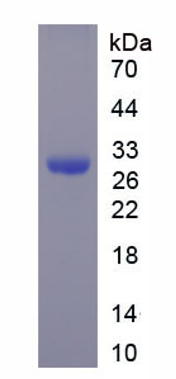 Mouse Recombinant Thioredoxin Reductase 1 (TrxR1)