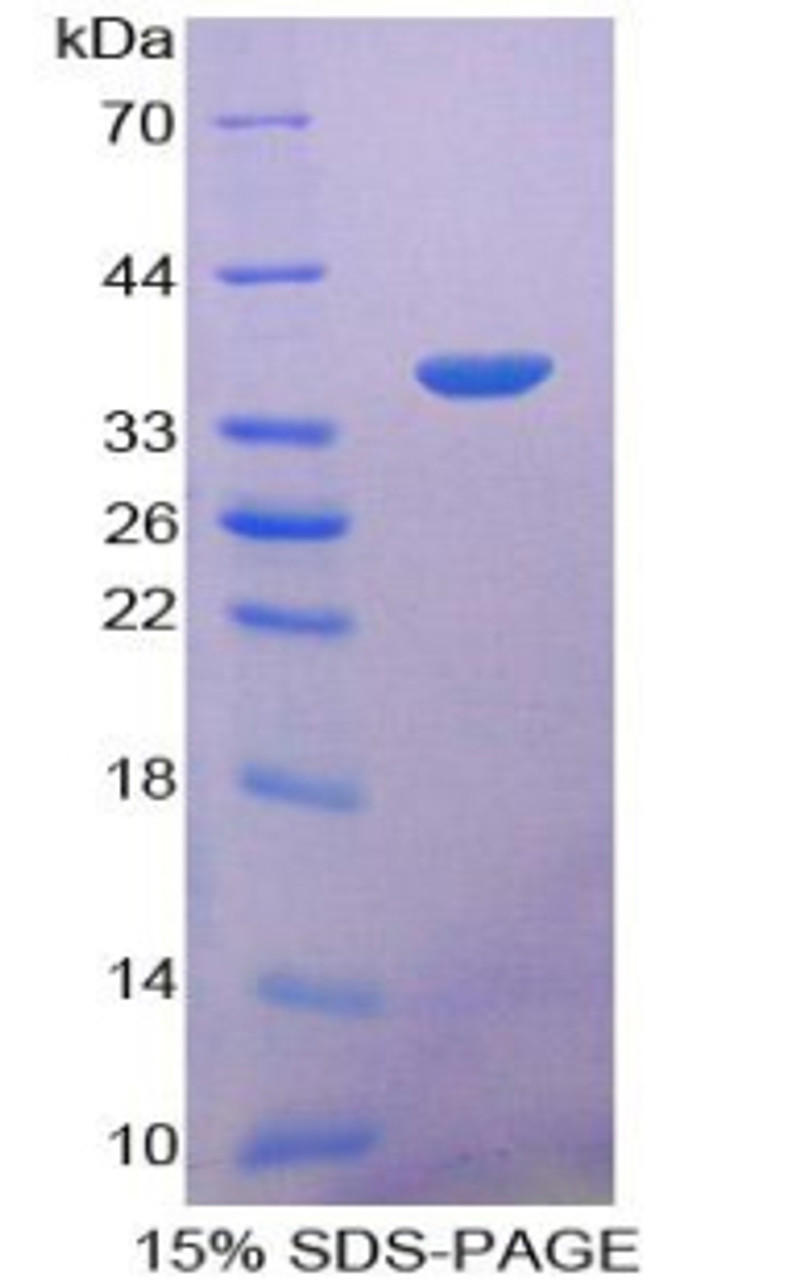 Mouse Recombinant Prothrombin Fragment 1+2 (F1+2)