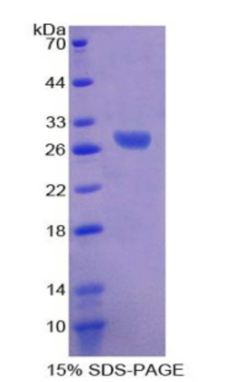 Rat Recombinant ATPase, Na+/K+ Transporting Beta 3 Polypeptide (ATP1b3)