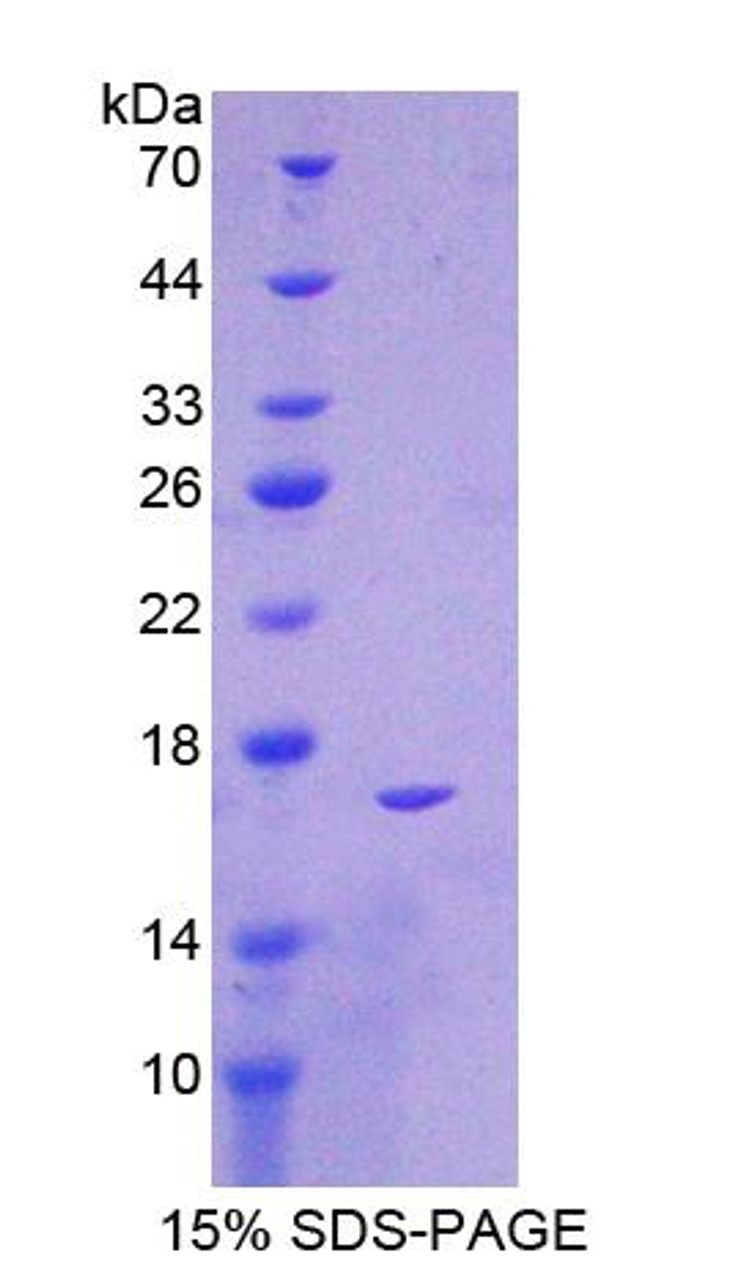 Mouse Recombinant Glucose 6 Phosphate Dehydrogenase (G6PD)