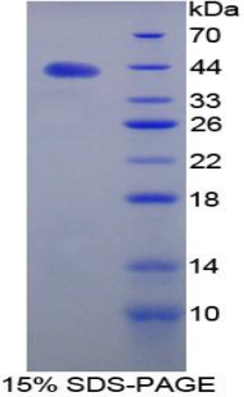 Mouse Recombinant C-Type Natriuretic Peptide (CNP)