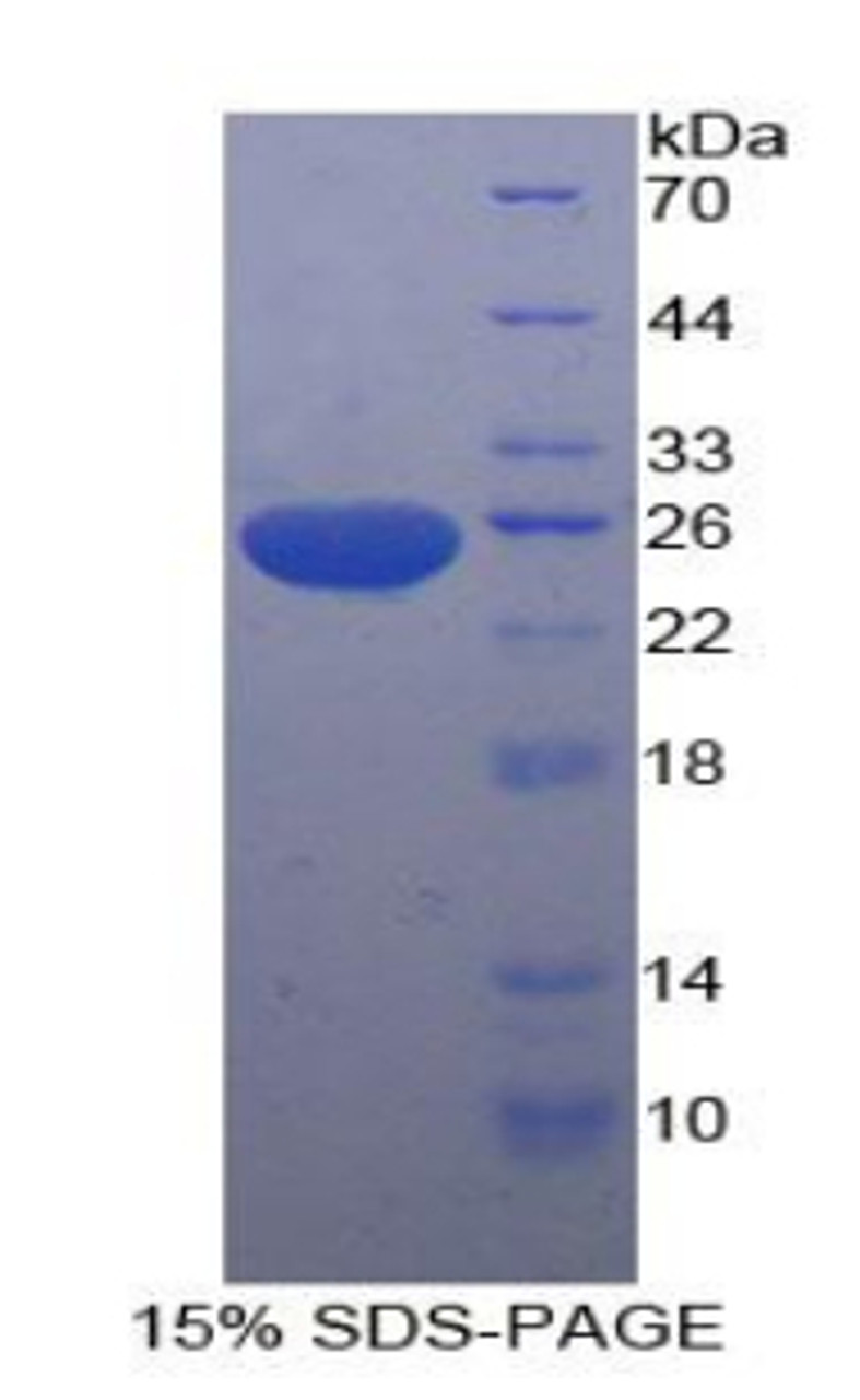 Rat Recombinant Stromal Cell Derived Factor 4 (SDF4)