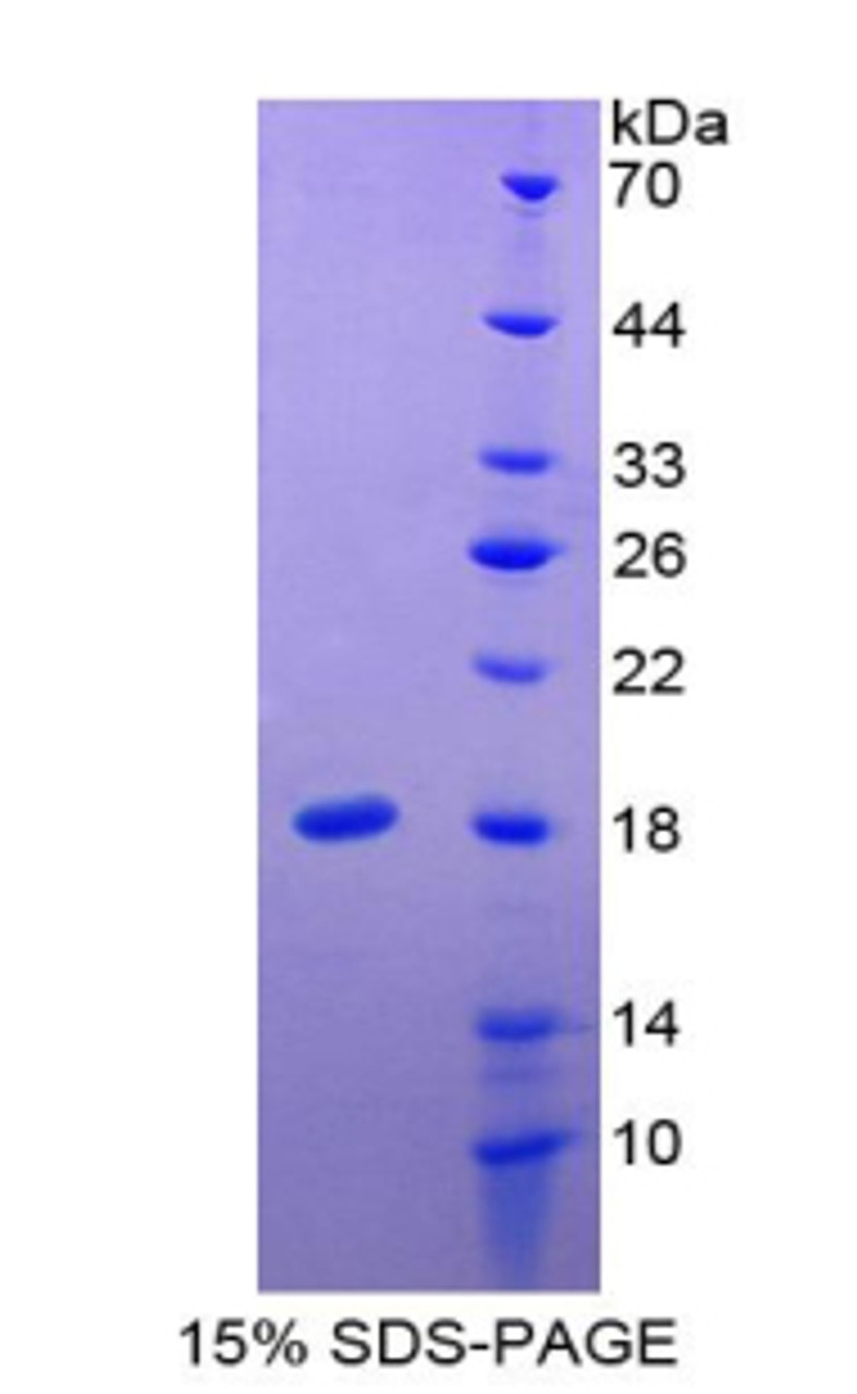 Pig Recombinant Transthyretin (TTR)