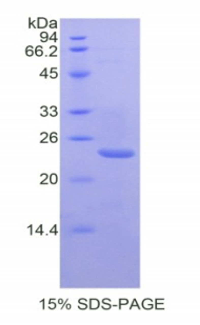 Mouse Recombinant Prostaglandin Endoperoxide Synthase 1 (PTGS1)