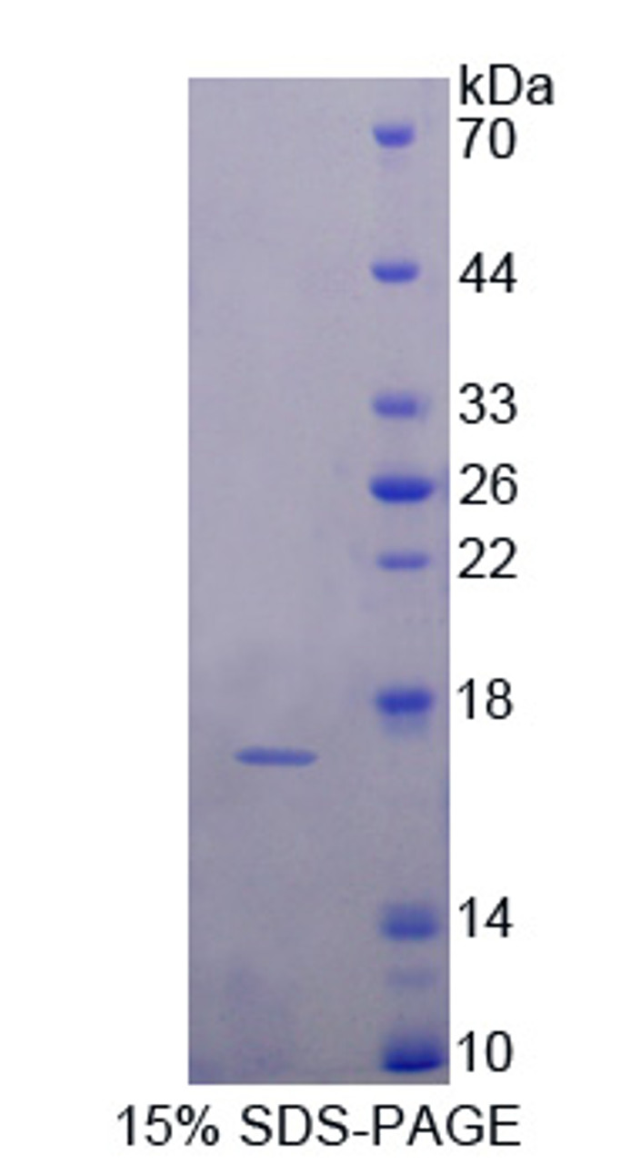 Rat Recombinant Complement Component 7 (C7)