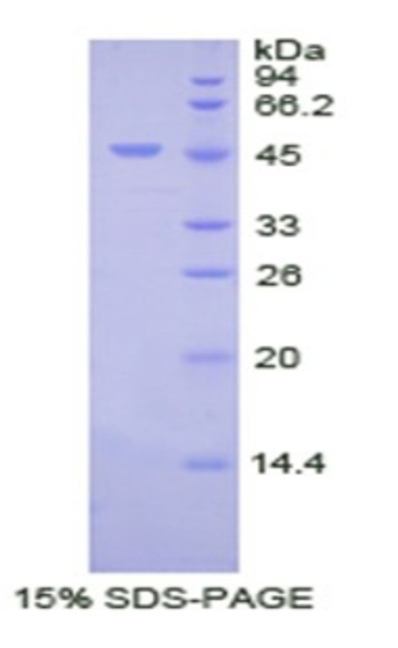 Human Recombinant Protein C (PROC)