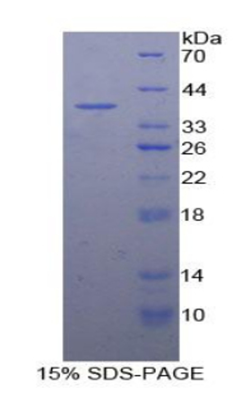 Human Recombinant Metallothionein 3 (MT3)