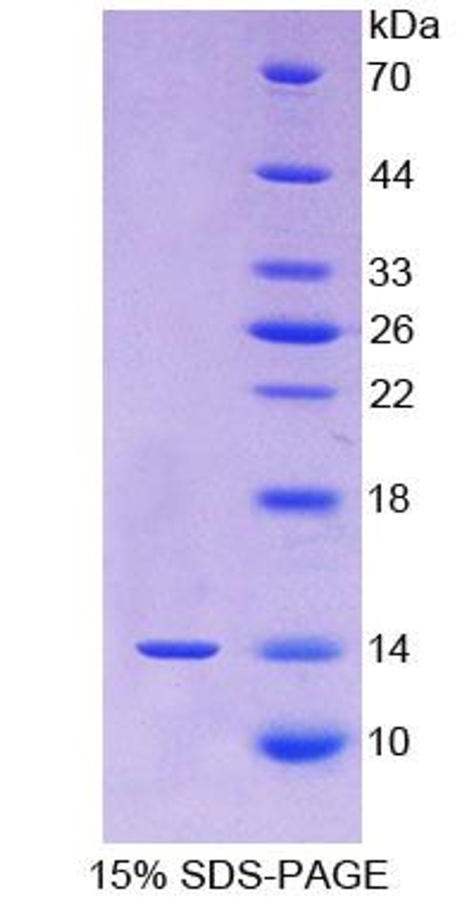 Human Recombinant Fibroblast Growth Factor 23 (FGF23)