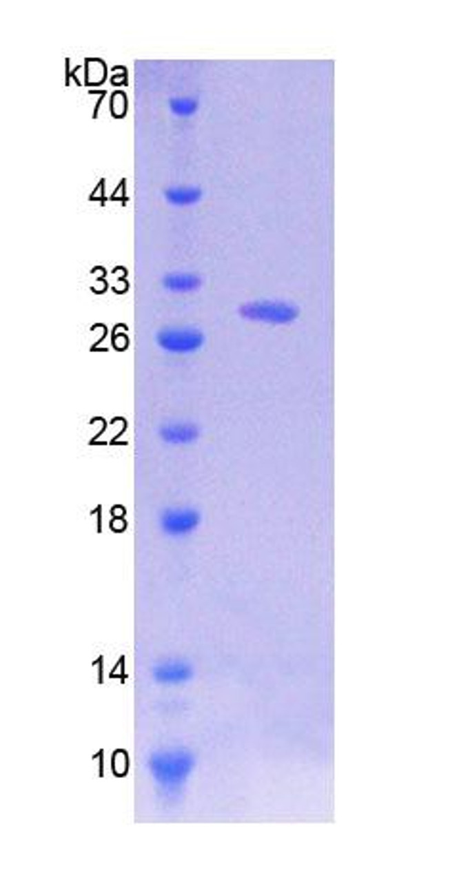 Human Recombinant Cyclic ADP Ribose Hydrolase (cADPRH)