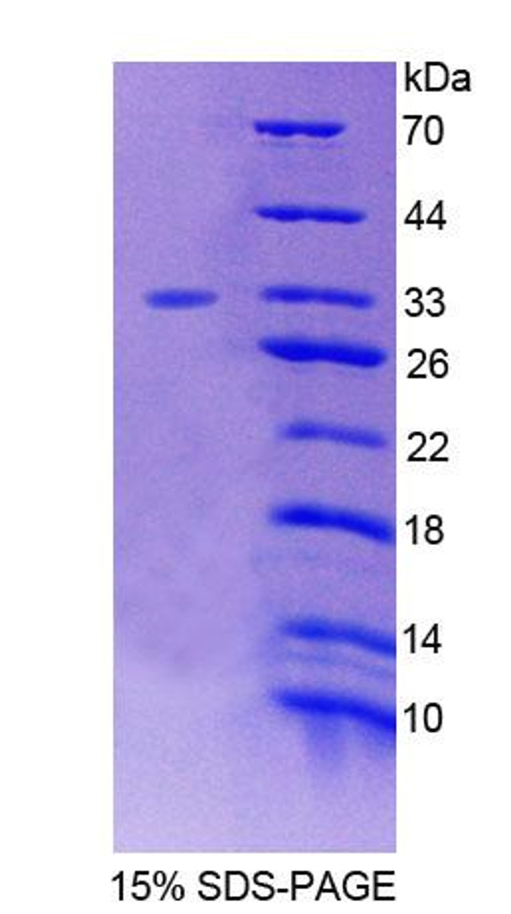 Human Recombinant Forkhead Box Protein O3 (FOXO3)