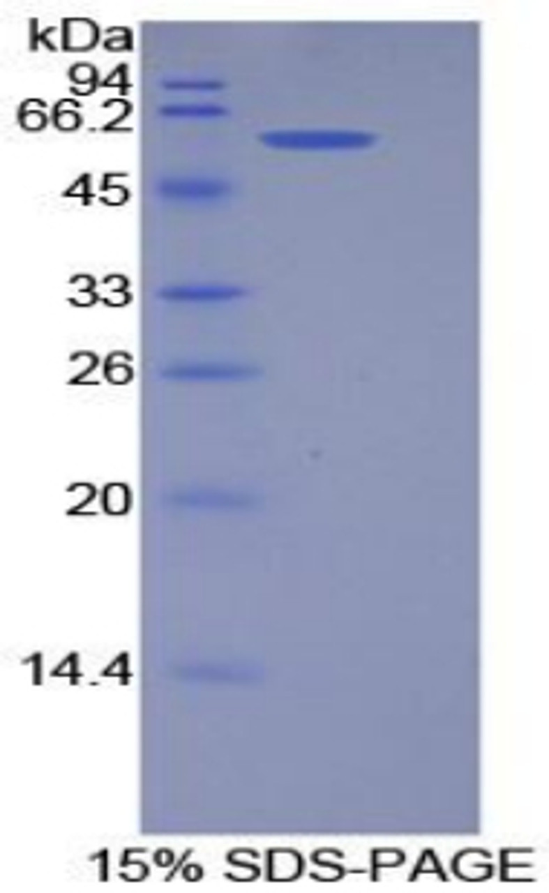 Human Recombinant Podocalyxin (PCX)