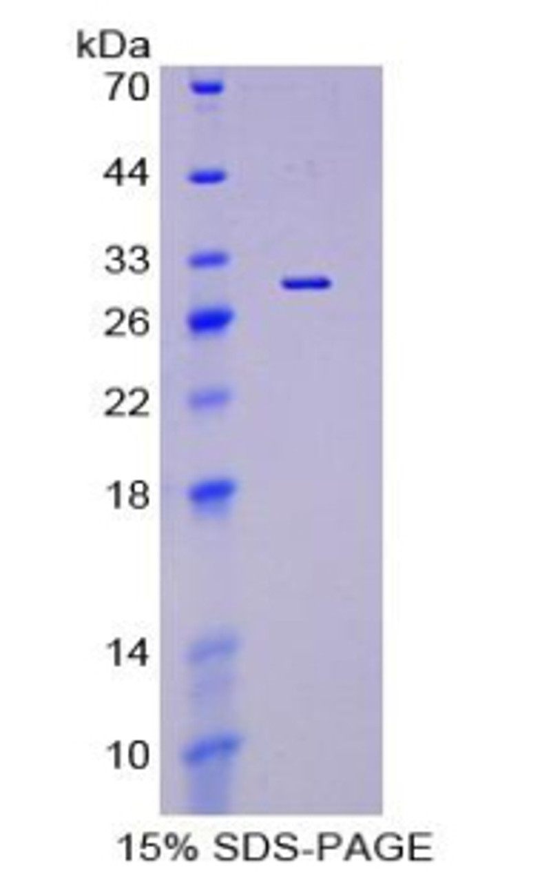 Rat Recombinant Podocalyxin (PCX)