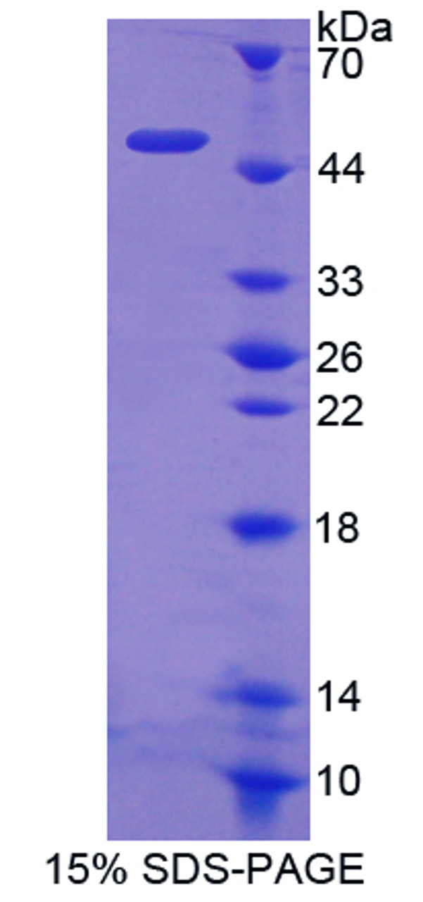 Rat Recombinant Hexokinase 1 (HK1)