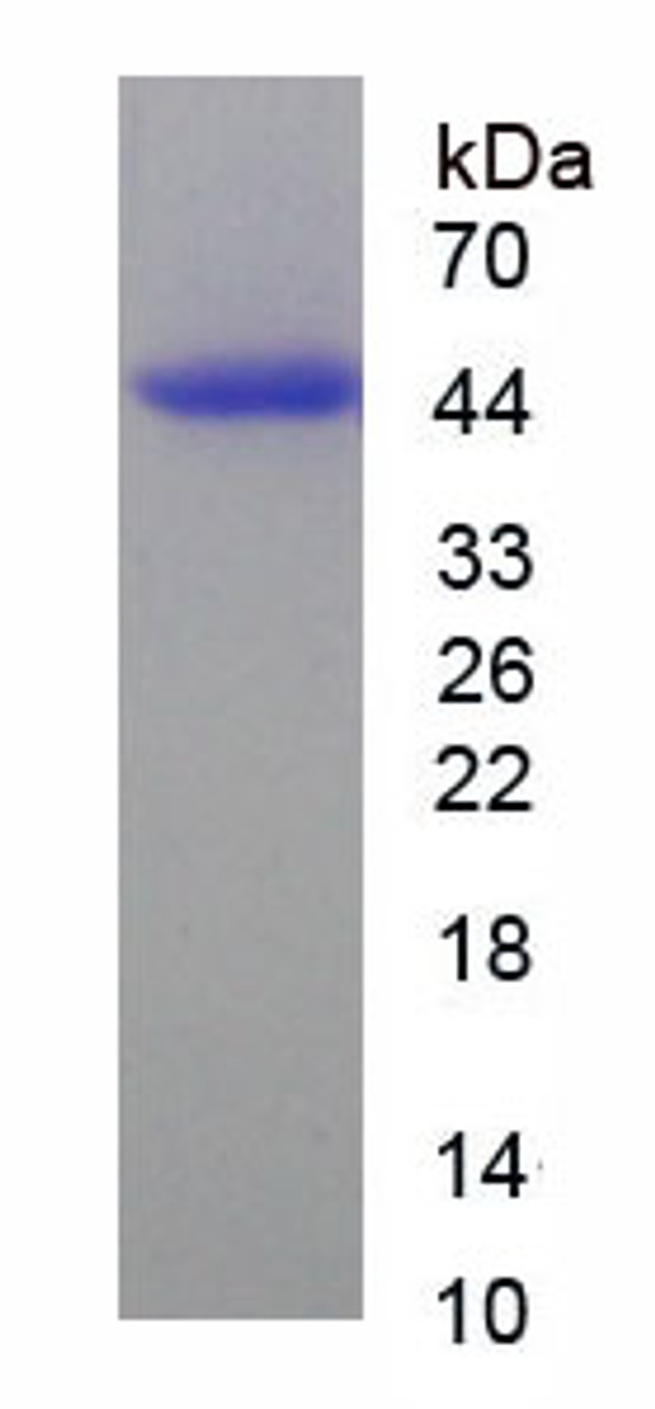 Human Recombinant Pyruvate Dehydrogenase Alpha (PDHa)