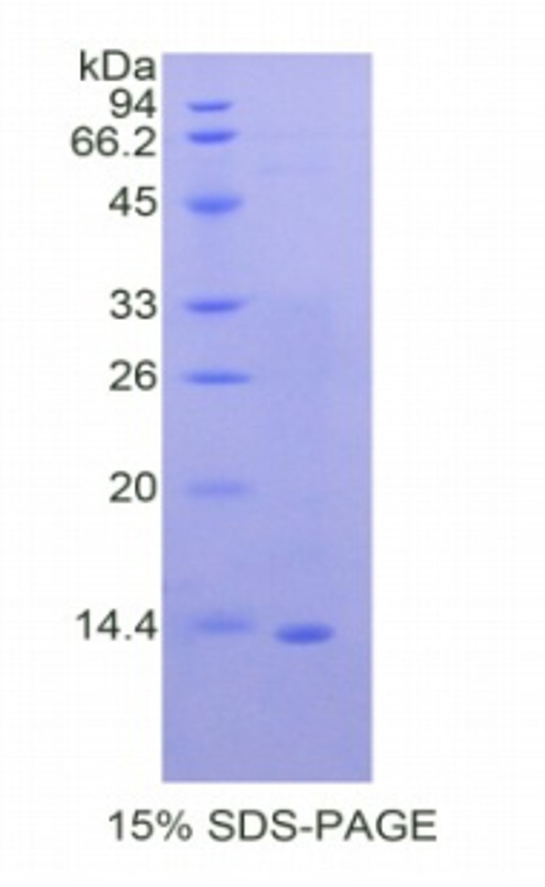 Human Recombinant Lactoferrin (LTF)