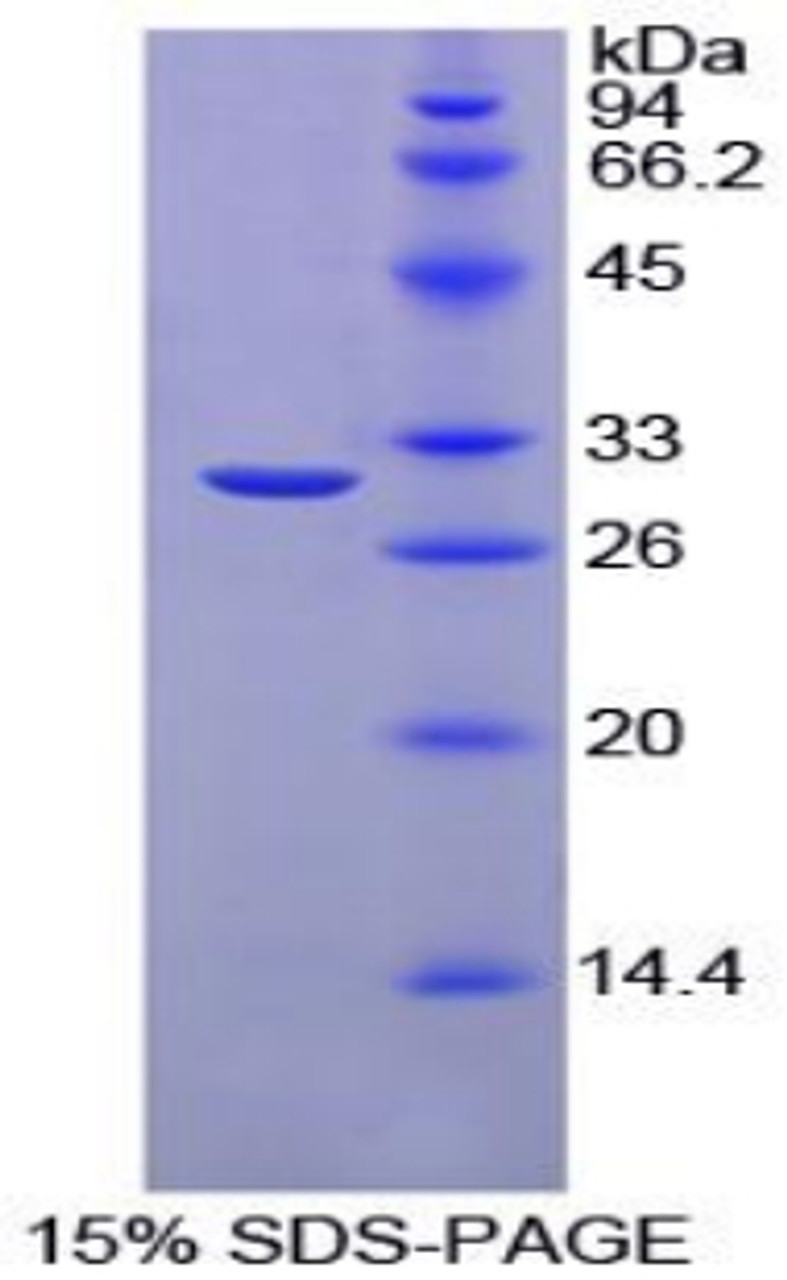 Chicken Recombinant Carbonic Anhydrase II (CA2)