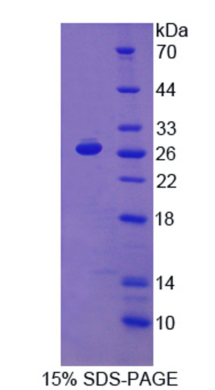 Human Recombinant Programmed Cell Death Protein 1 Ligand 2 (PDCD1LG2)