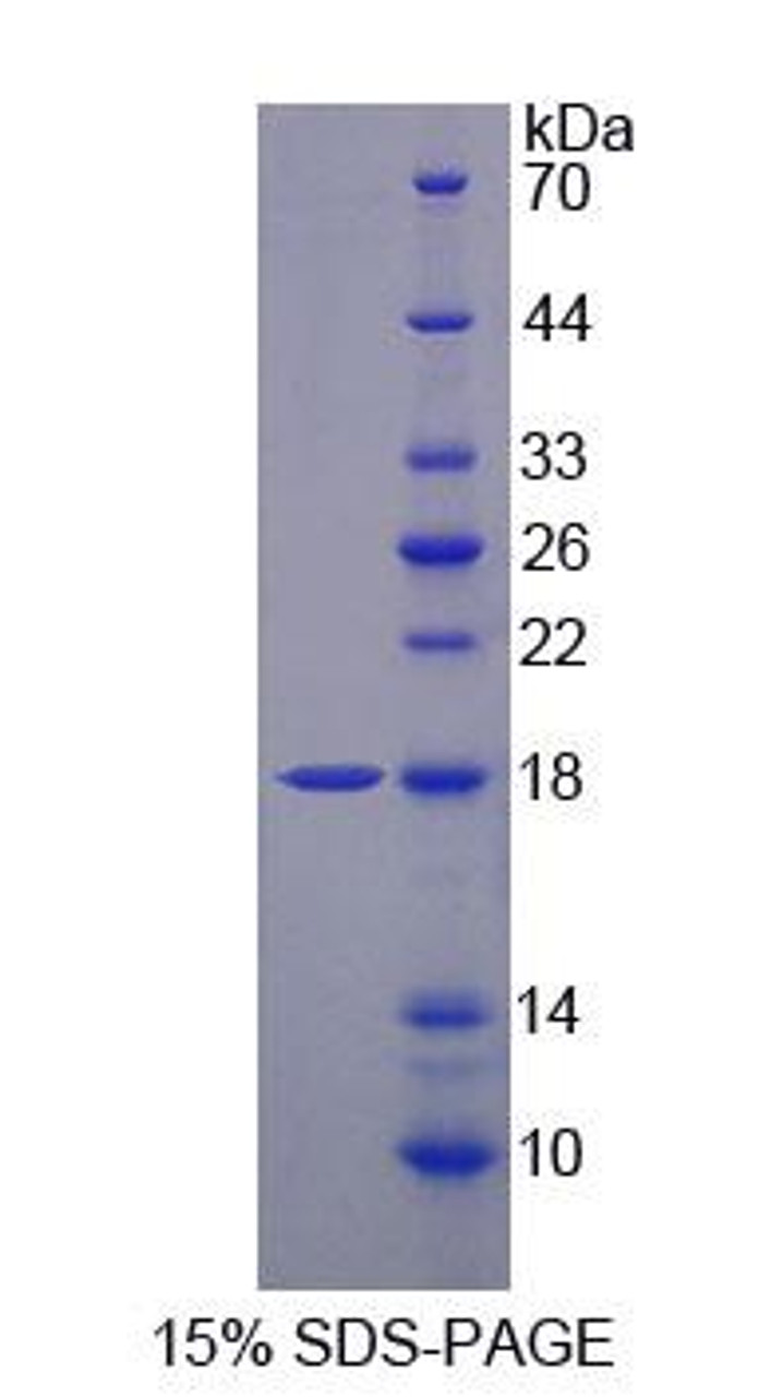 Mouse Recombinant Tumor Necrosis Factor Receptor Superfamily, Member 17 (TNFRSF17)