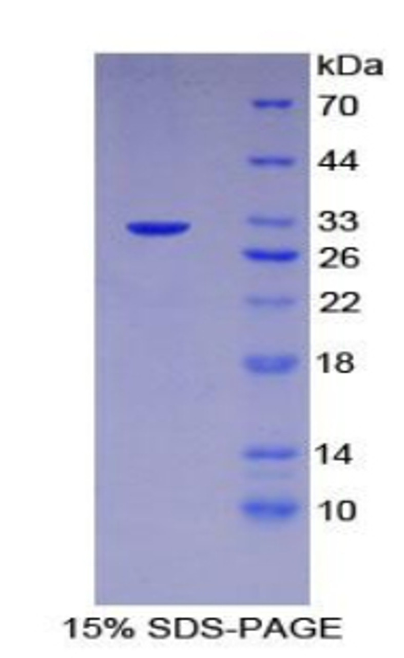 Mouse Recombinant Topoisomerase II (TOP2)