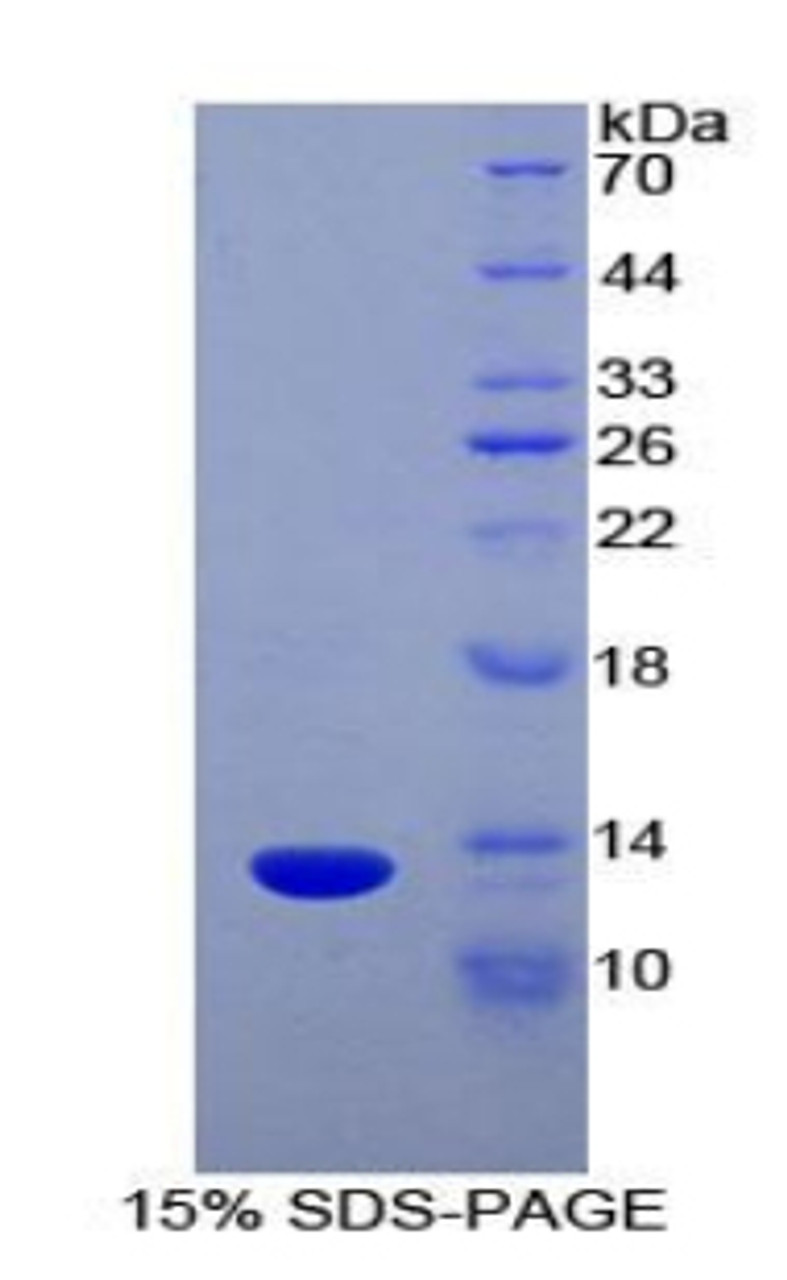 Human Recombinant Lymphotactin (Lptn)