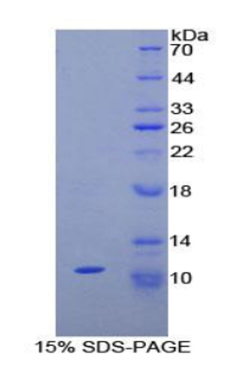 Rat Recombinant Neuropeptide S (NPS)