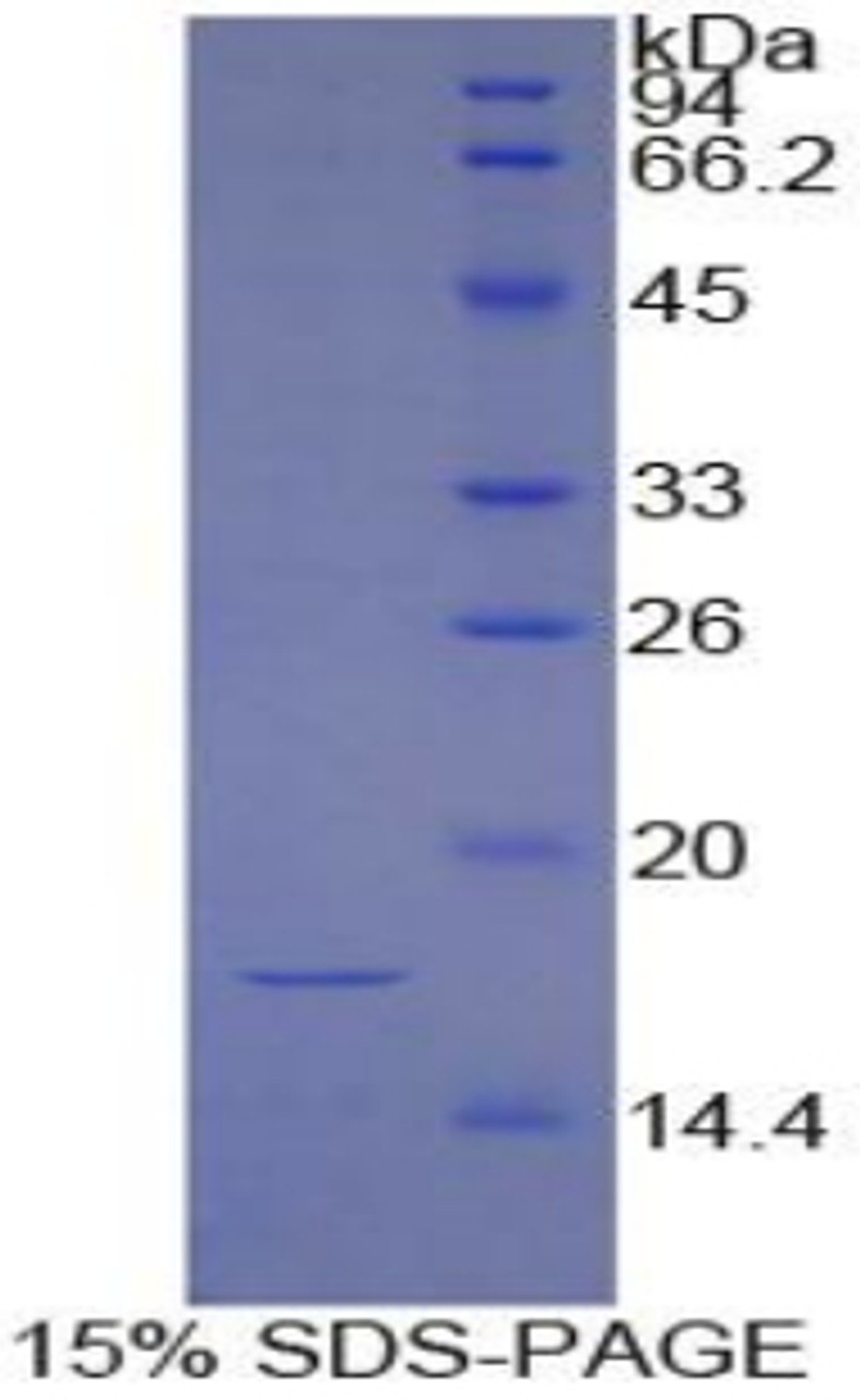 Cattle Recombinant Hypoxia Inducible Factor 1 Alpha (HIF1a)