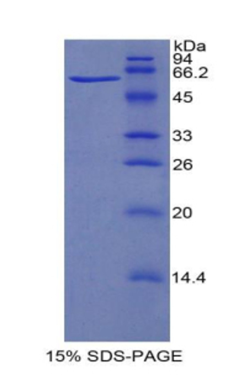 Cattle Recombinant Hypoxia Inducible Factor 1 Alpha (HIF1a)