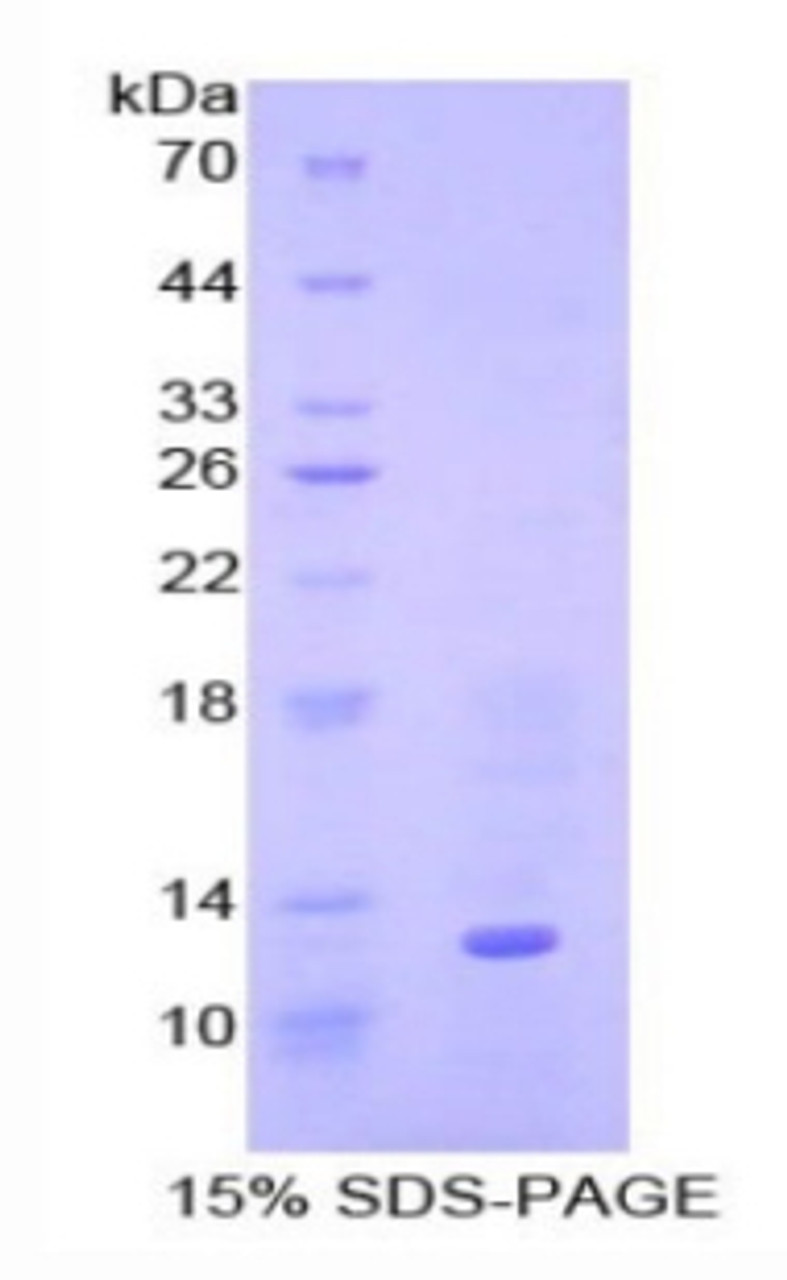 Human Recombinant Bone Morphogenetic Protein 7 (BMP7)