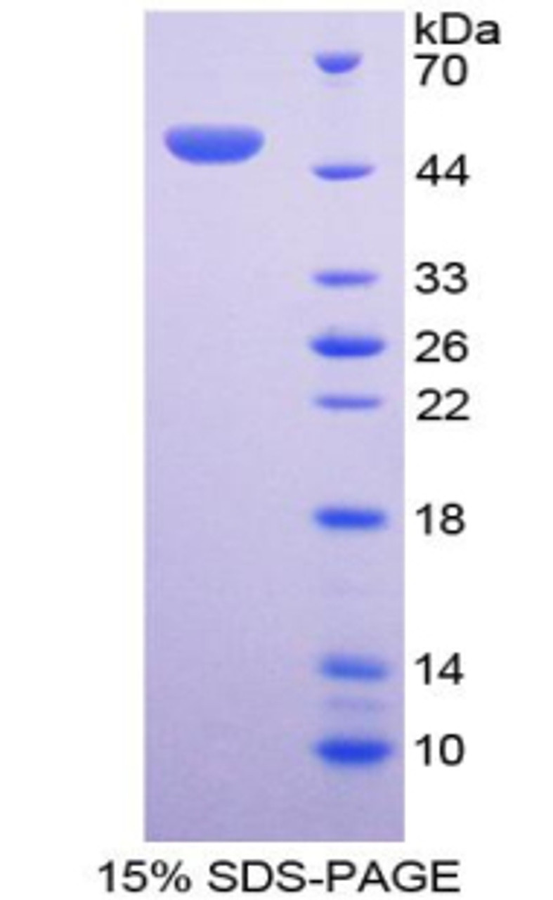 Human Recombinant Bone Morphogenetic Protein 7 (BMP7)