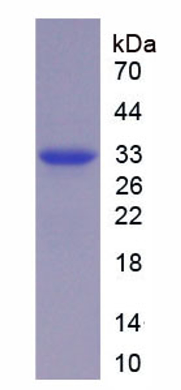 Human Recombinant Pregnancy Associated Plasma Protein A (PAPPA)