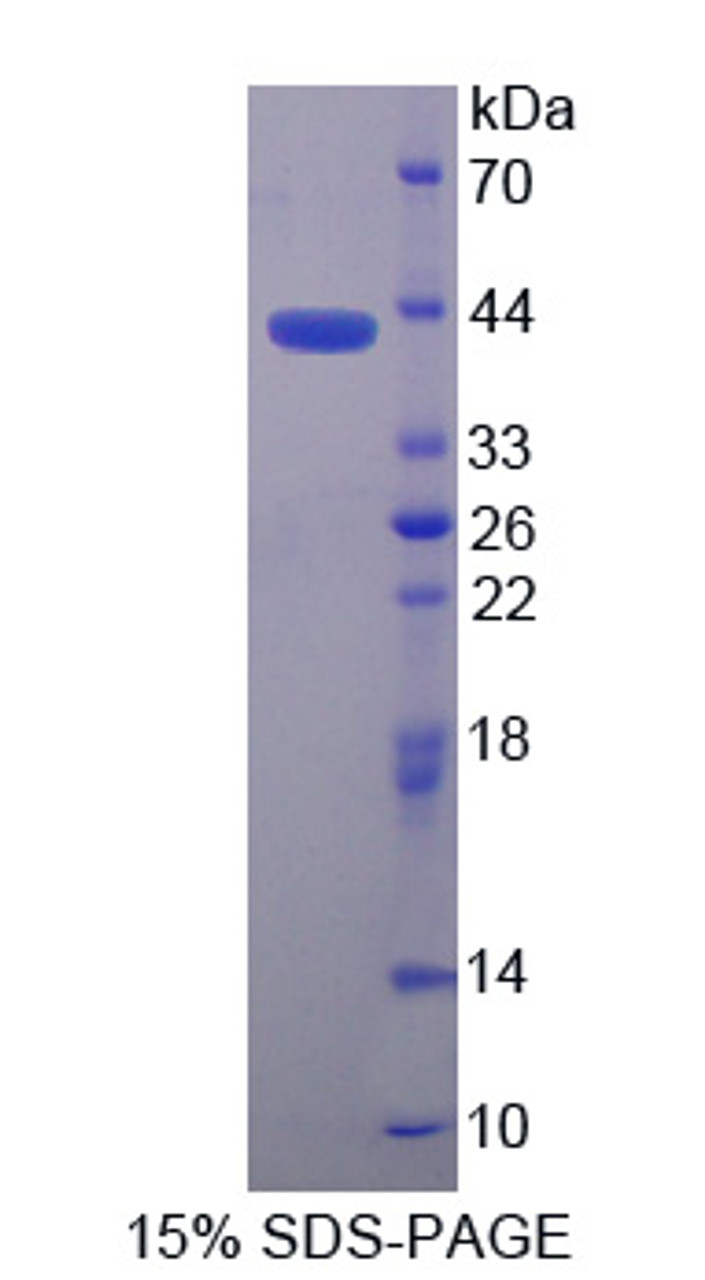 Human Recombinant Neuromedin B (NMB)