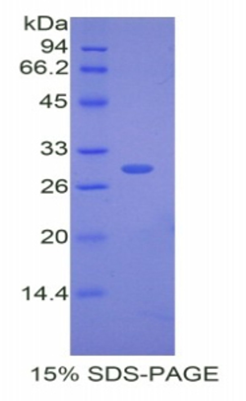 Rabbit Recombinant Cholesteryl Ester Transfer Protein (CETP)