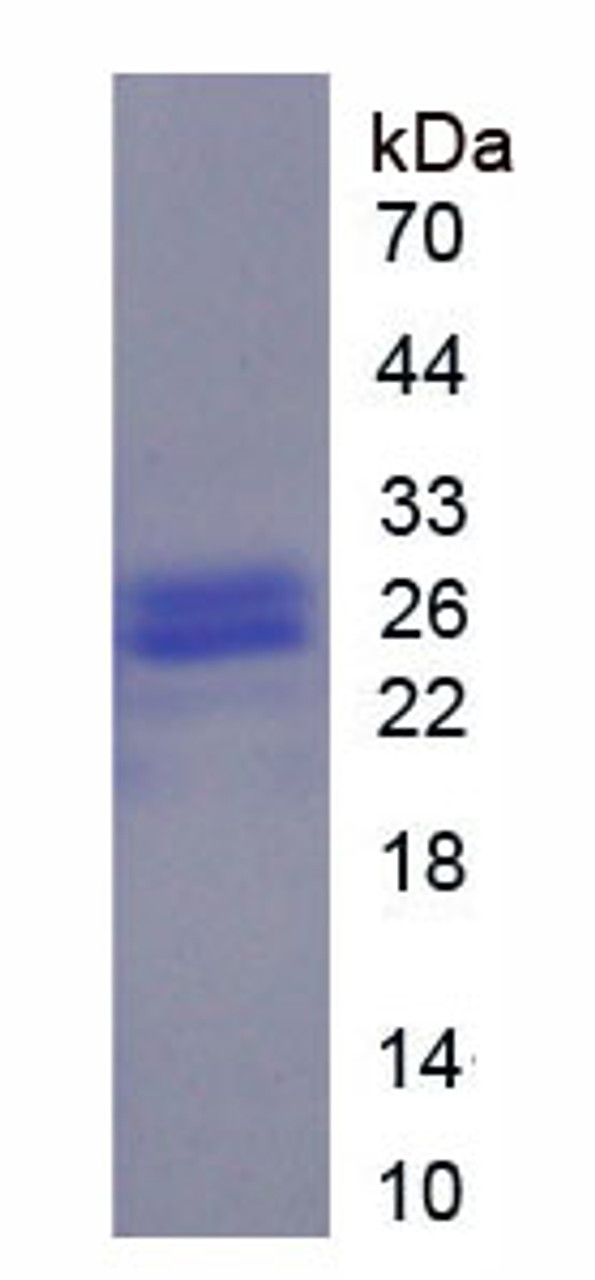 Pig Recombinant Alpha-1-Acid Glycoprotein (a1AGP)