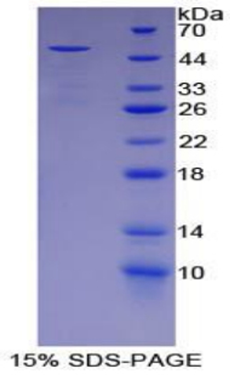 Rat Recombinant Alpha-1-Acid Glycoprotein (a1AGP)