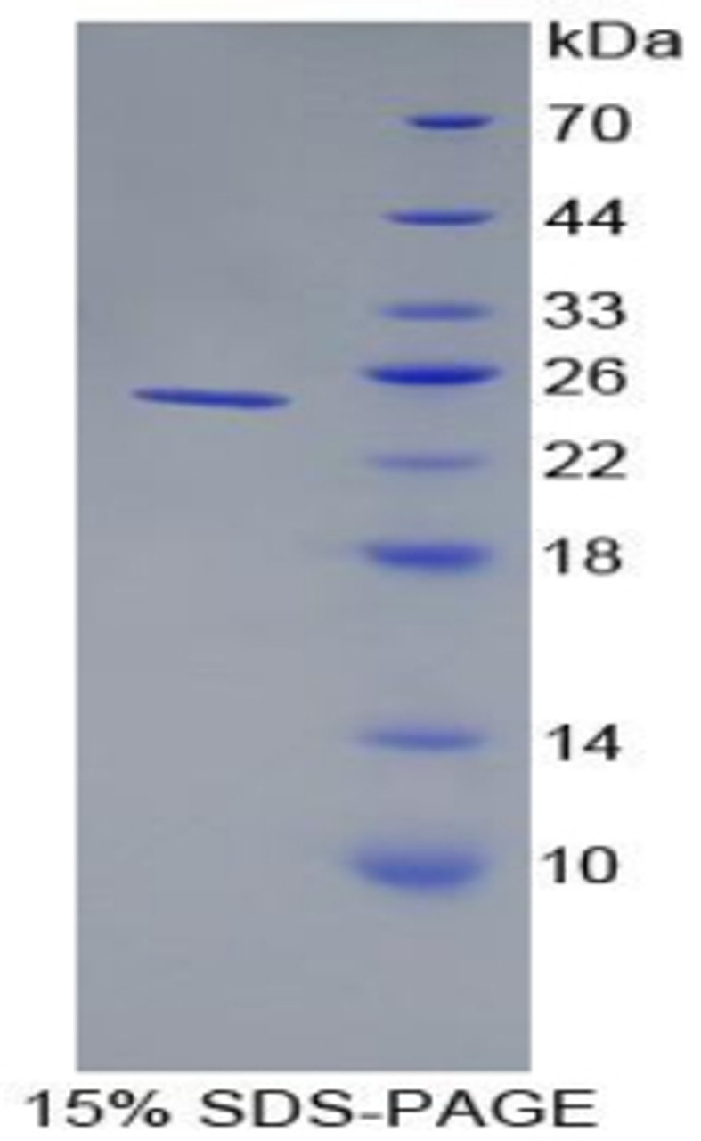 Rat Recombinant Alpha-1-Acid Glycoprotein (a1AGP)