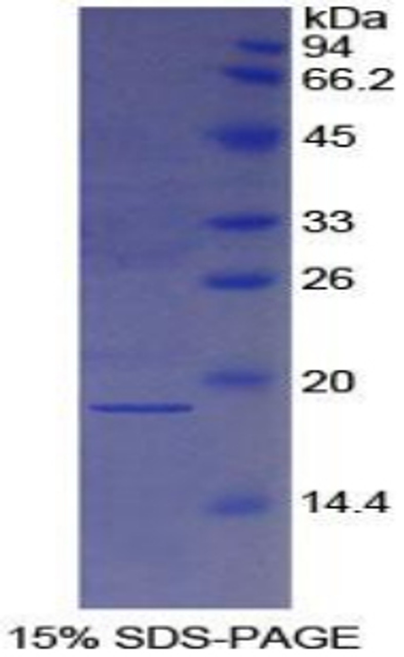 Human Recombinant Haptoglobin (Hpt)