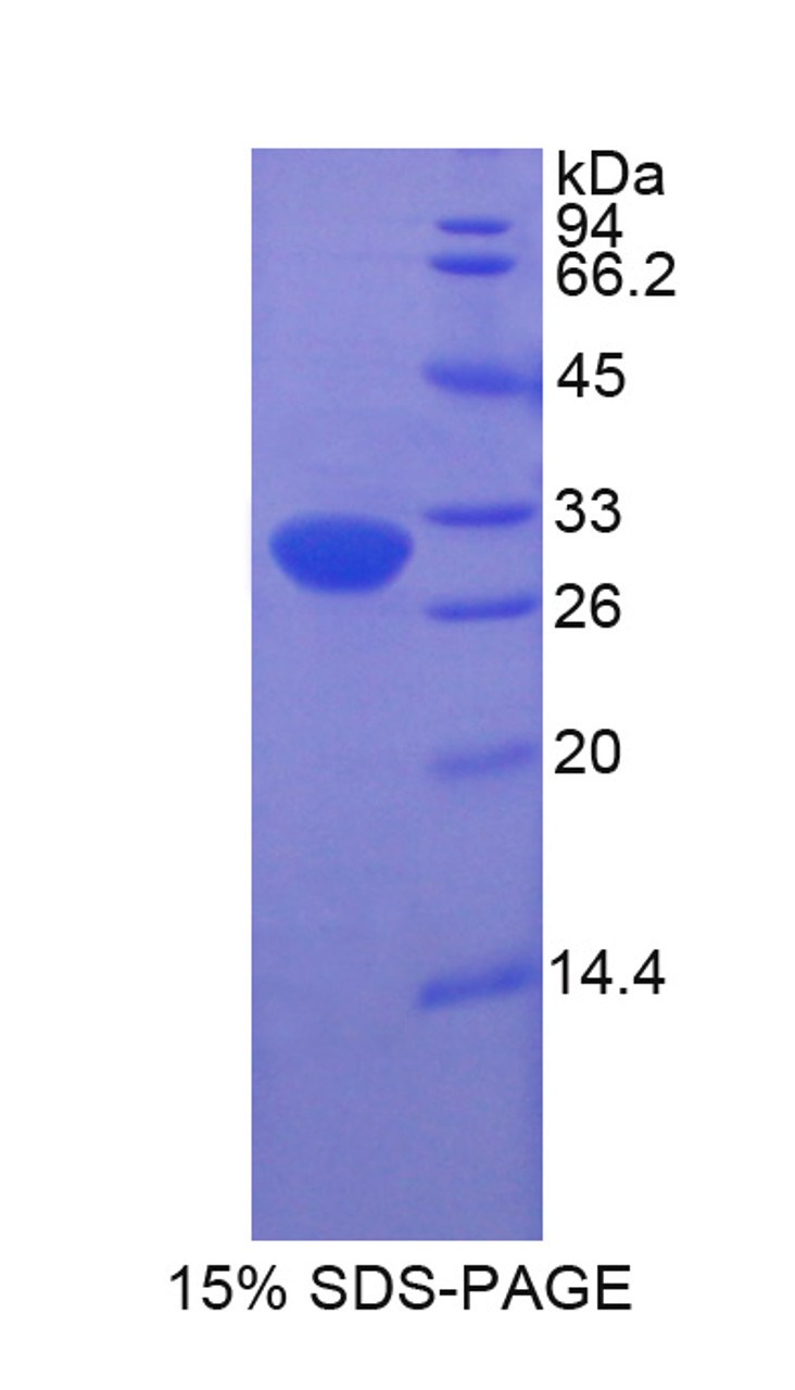 Rat Recombinant Haptoglobin Related Protein (HPR)
