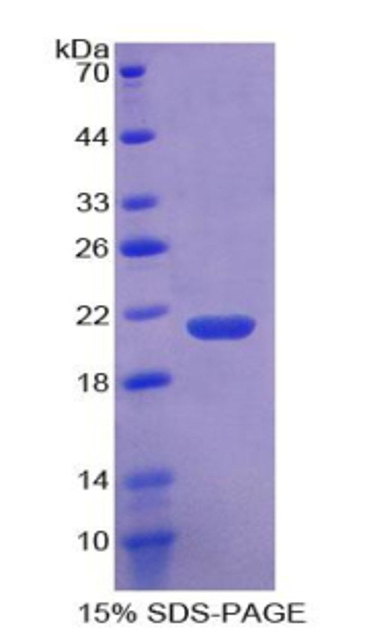 Human Recombinant Coagulation Factor II (F2)