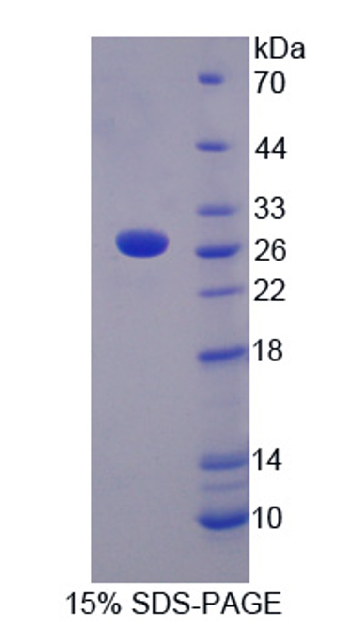 Chicken Recombinant C Reactive Protein (CRP)