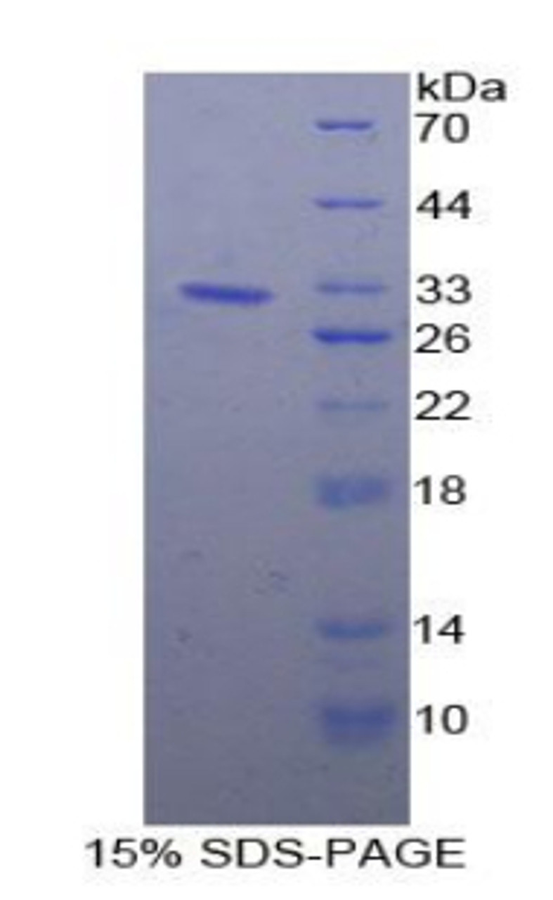 Human Recombinant Heat Shock Protein 90kDa Beta 1 (HSP90b1)