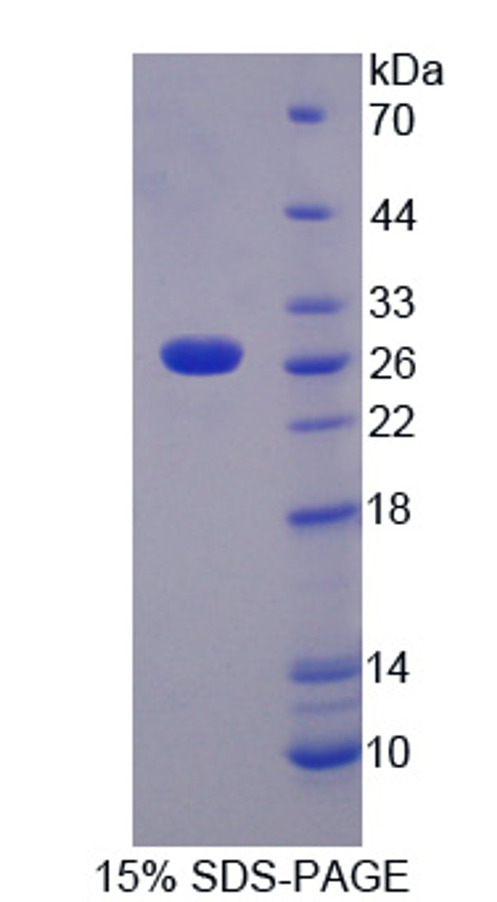 Human Recombinant Tumor Necrosis Factor Ligand Superfamily, Member 14 (TNFSF14)