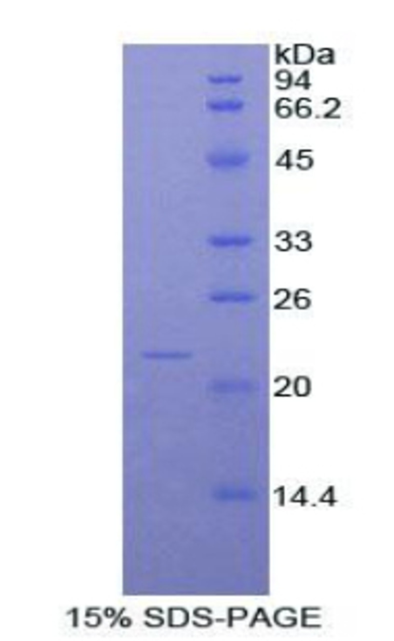 Rat Recombinant Nitric Oxide Synthase 2, Inducible (NOS2)