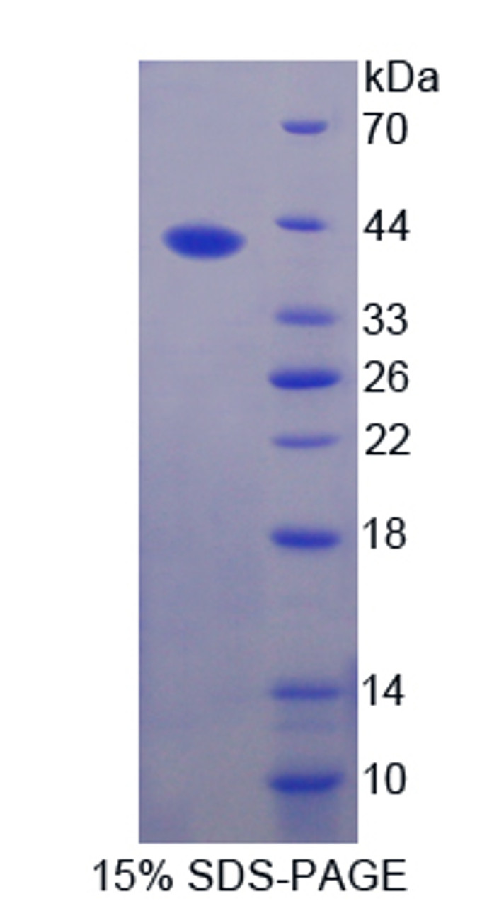 Cattle Recombinant Resistin (RETN)