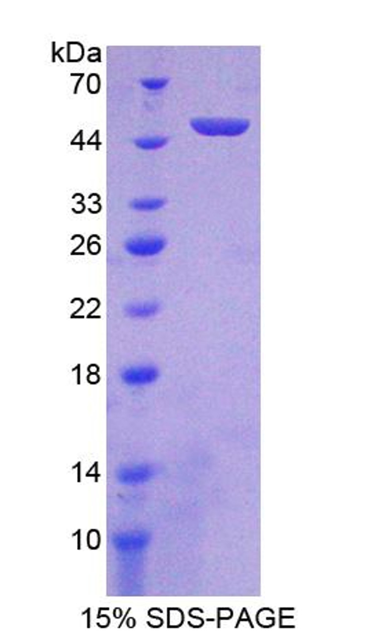 Mouse Recombinant Receptor Activator Of Nuclear Factor Kappa B Ligand (RANkL)