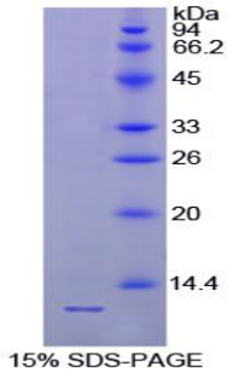 Chicken Recombinant Parathyroid Hormone (PTH)